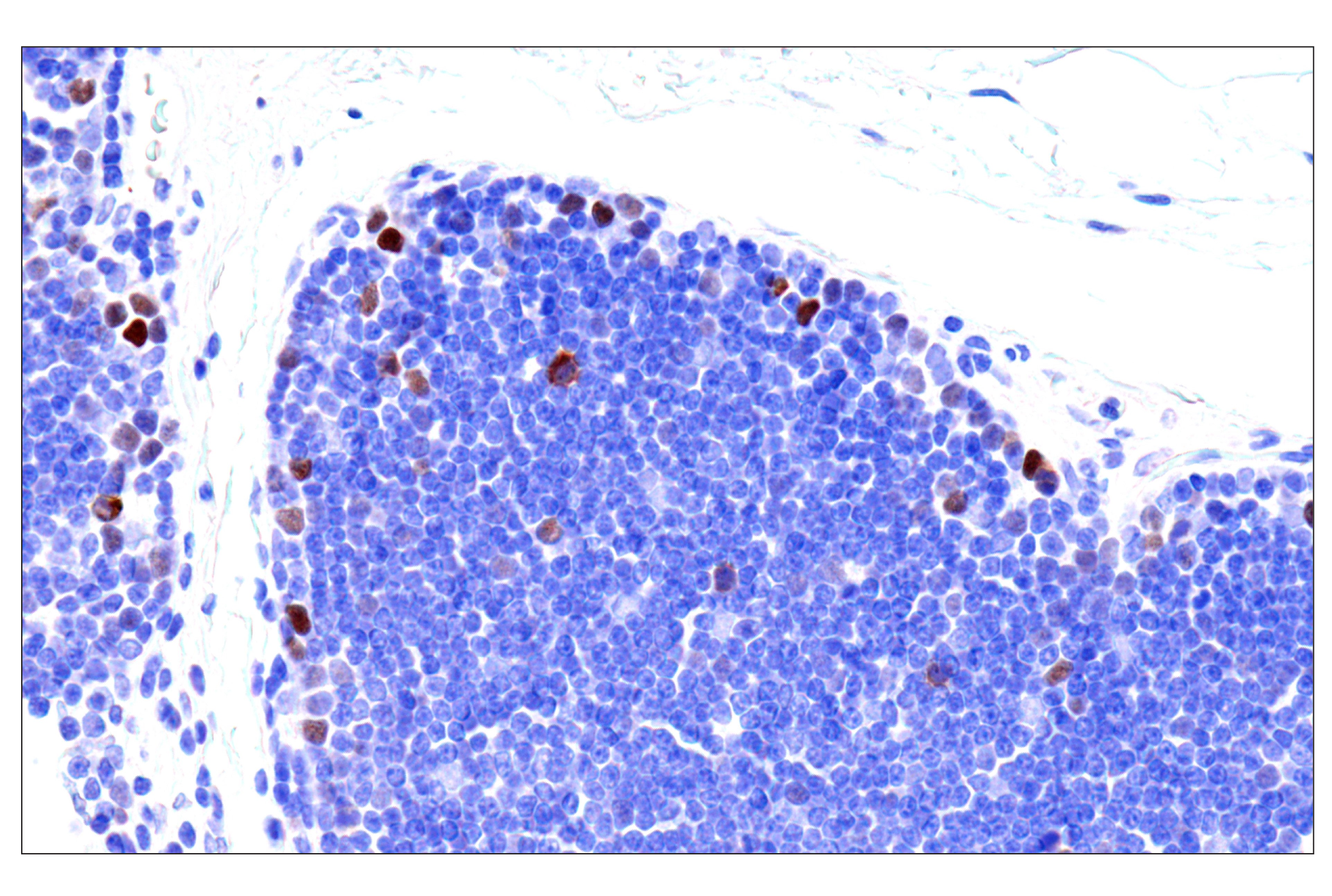Immunohistochemistry Image 7: Phospho-NPM1 (Thr199) (E4C7S) Rabbit mAb (BSA and Azide Free)