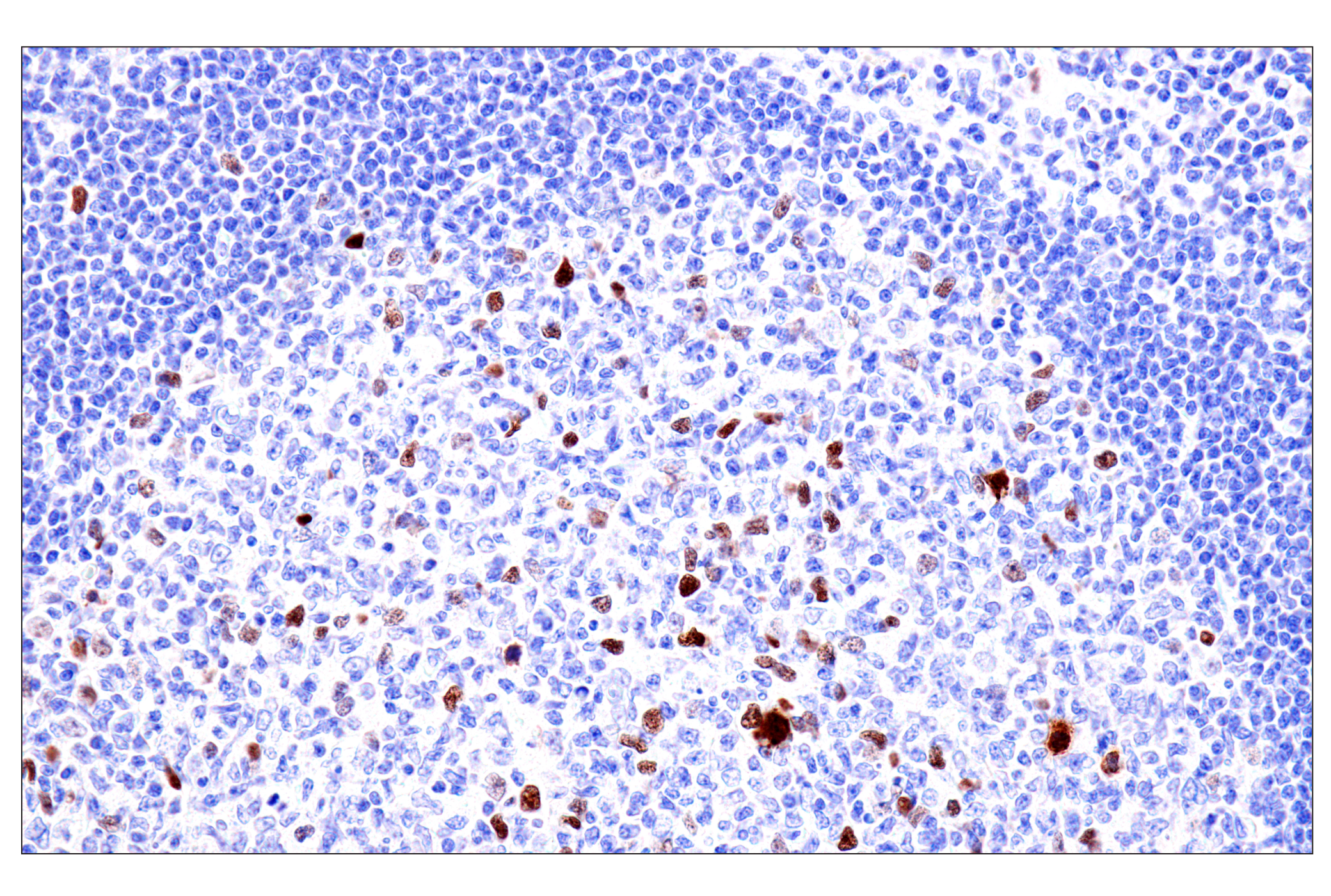 Immunohistochemistry Image 6: Phospho-NPM1 (Thr199) (E4C7S) Rabbit mAb (BSA and Azide Free)