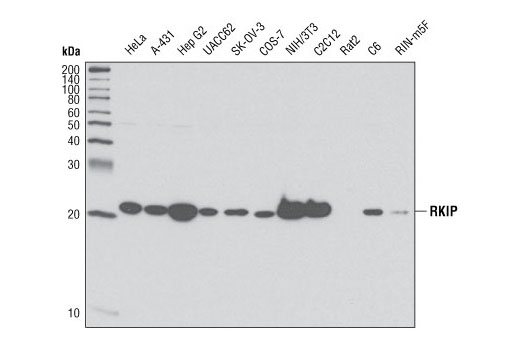 Western Blotting Image 1: RKIP (V177) Antibody