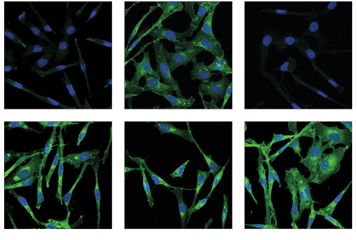  Image 23: Angiogenesis Receptor Tyrosine Kinase Antibody Sampler Kit