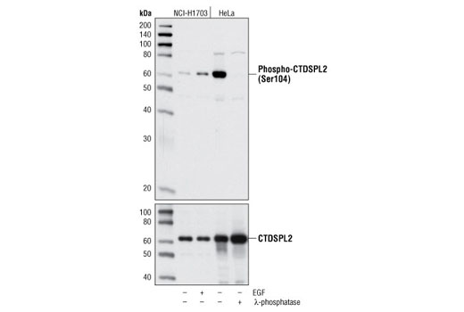 Western Blotting Image 1: Phospho-CTDSPL2 (Ser104) Antibody