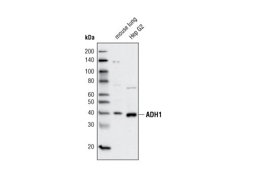 Western Blotting Image 1: ADH1 Antibody