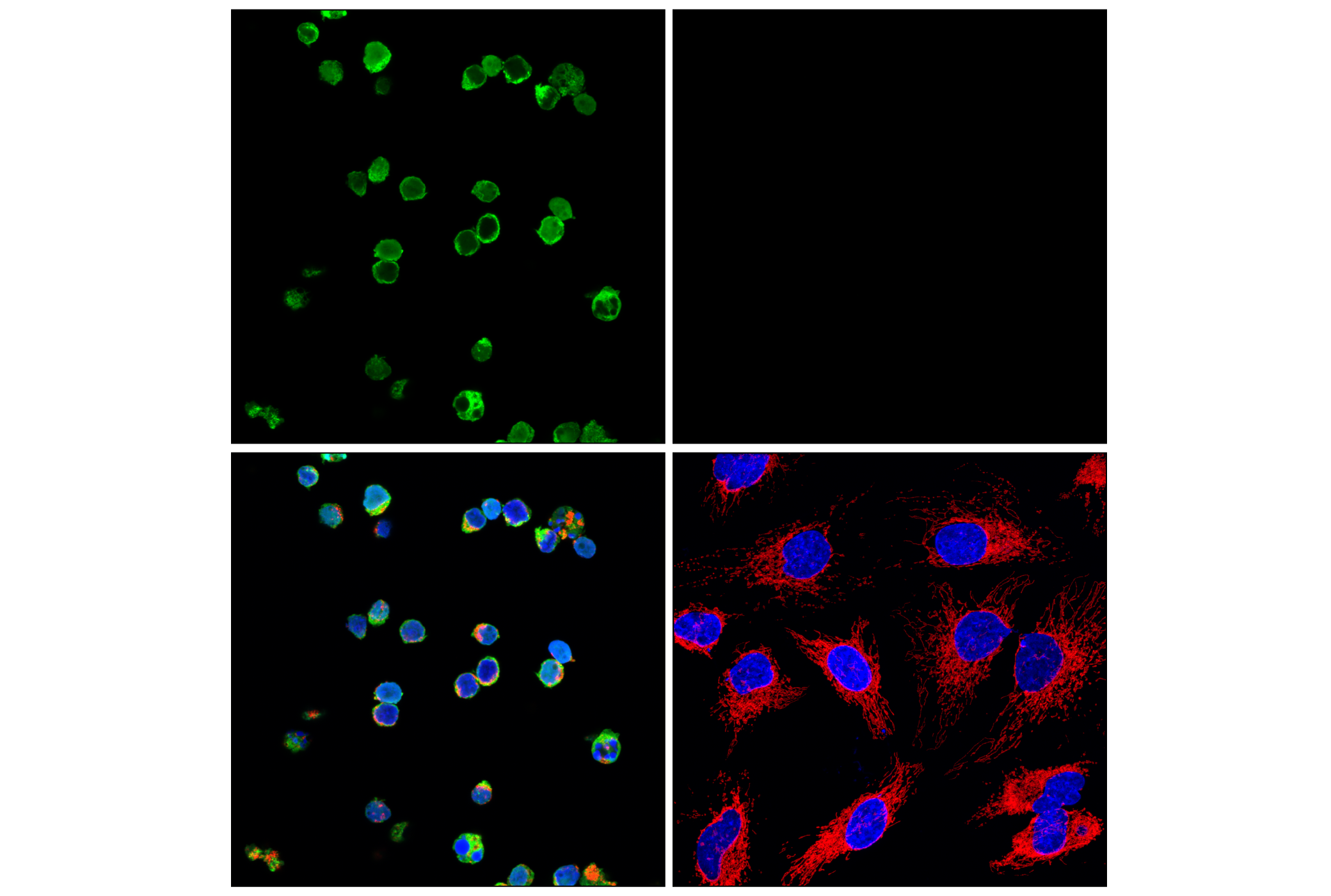Immunofluorescence Image 1: Myeloperoxidase (E2Z8J) Rabbit mAb (Alexa Fluor® 488 Conjugate)