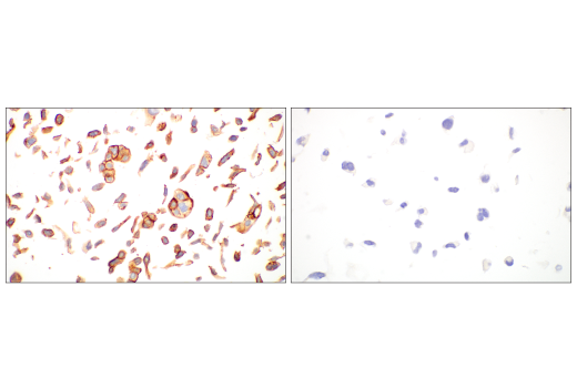 Immunohistochemistry Image 12: Integrin β6 (E4M9P) XP® Rabbit mAb (BSA and Azide Free)