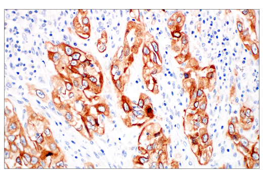 Immunohistochemistry Image 6: Integrin β6 (E4M9P) XP® Rabbit mAb (BSA and Azide Free)