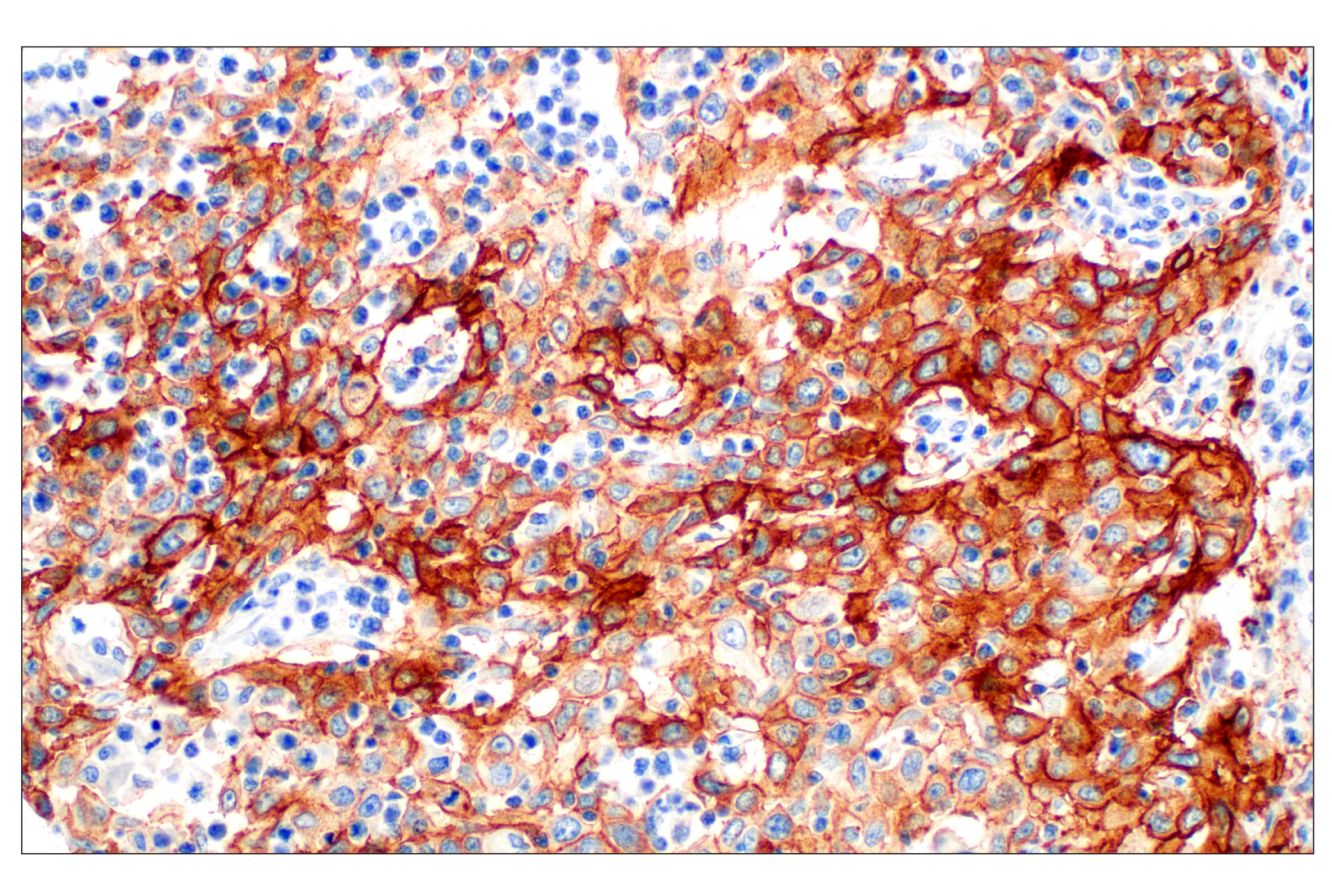 Immunohistochemistry Image 3: Integrin β6 (E4M9P) XP® Rabbit mAb (BSA and Azide Free)