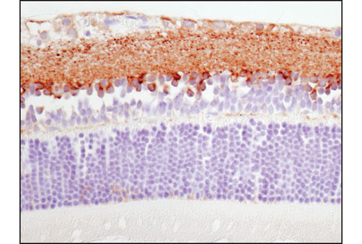 Immunohistochemistry Image 3: Synapsin-1 (D12G5) XP® Rabbit mAb