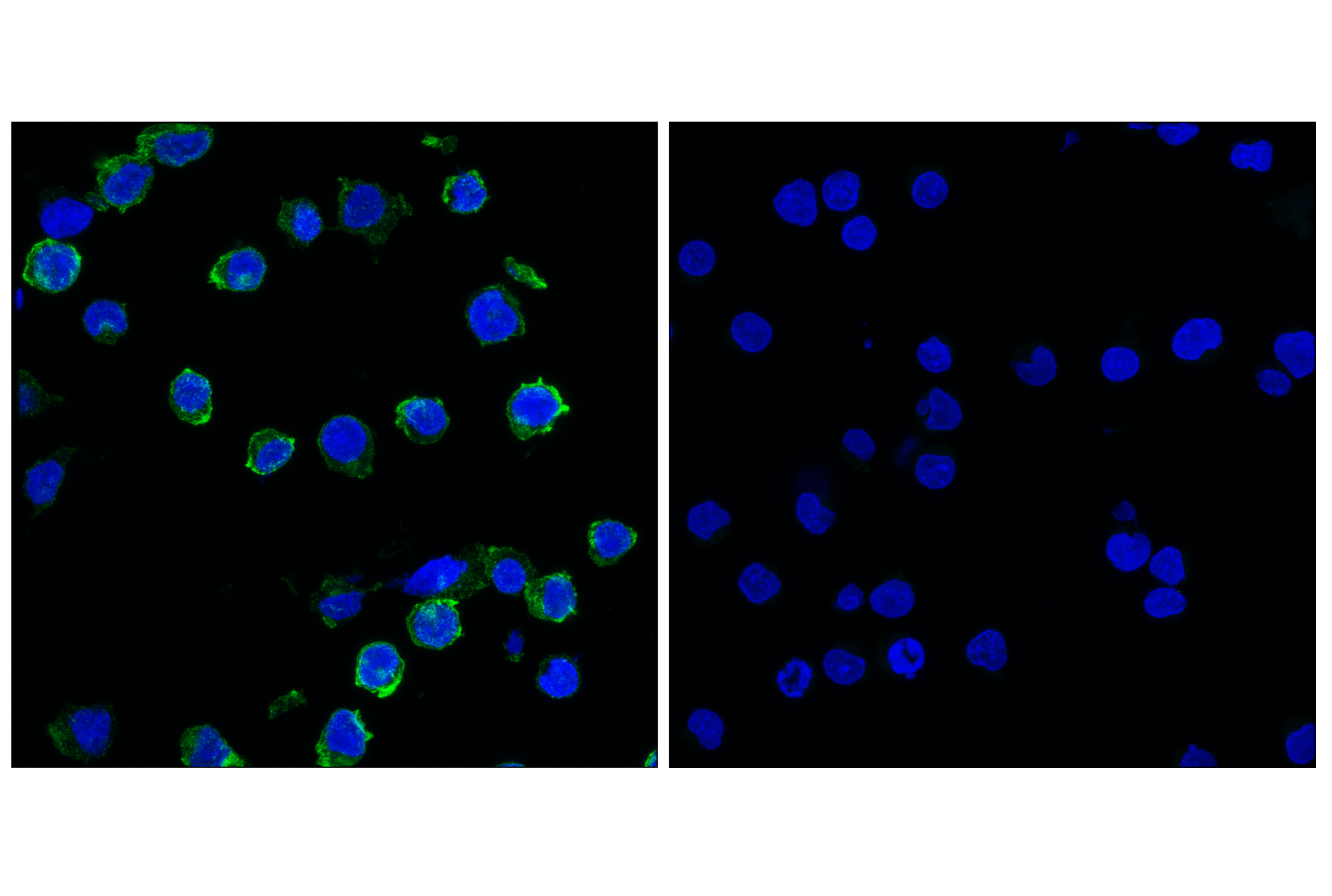 Immunofluorescence Image 1: RANK (E2N2Y) Rabbit mAb