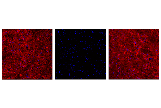 Immunofluorescence Image 1: Phospho-Tau (Thr205) (E7D3E) Rabbit mAb (Alexa Fluor® 647 Conjugate)