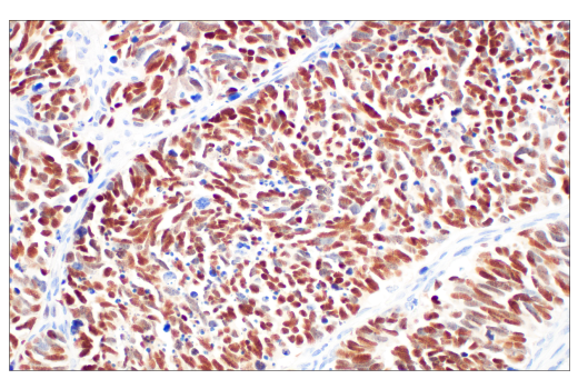 Immunohistochemistry Image 1: ASCL1 (E5S4Q) XP® Rabbit mAb (BSA and Azide Free)