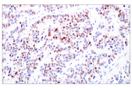 Immunohistochemistry Image 2: ASCL1 (E5S4Q) XP<sup>®</sup> Rabbit mAb (BSA and Azide Free)