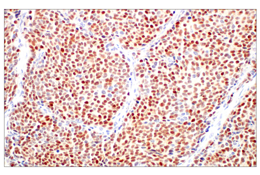 Immunohistochemistry Image 1: ASCL1 (E5S4Q) XP<sup>®</sup> Rabbit mAb (BSA and Azide Free)