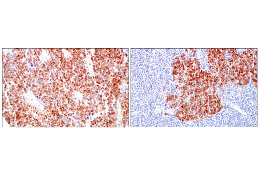 Immunohistochemistry Image 5: ASCL1 (E5S4Q) XP® Rabbit mAb (BSA and Azide Free)
