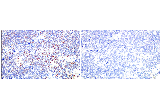 Immunohistochemistry Image 6: ASCL1 (E5S4Q) XP® Rabbit mAb (BSA and Azide Free)