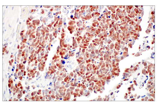 Immunohistochemistry Image 3: ASCL1 (E5S4Q) XP<sup>®</sup> Rabbit mAb (BSA and Azide Free)