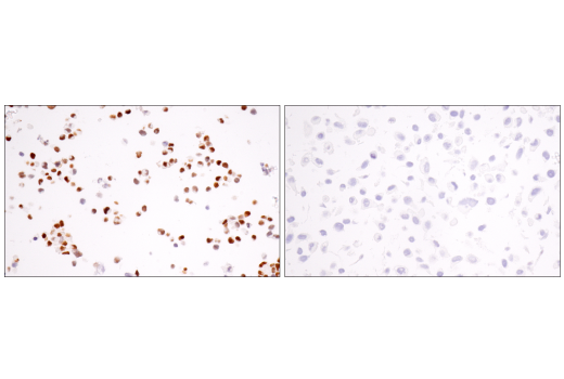 Immunohistochemistry Image 7: ASCL1 (E5S4Q) XP® Rabbit mAb (BSA and Azide Free)