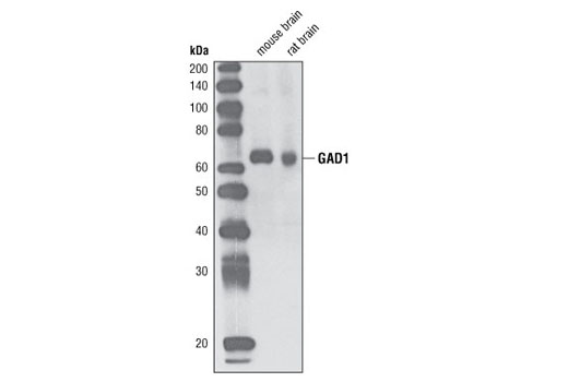 Western Blotting Image 1: GAD1 Antibody