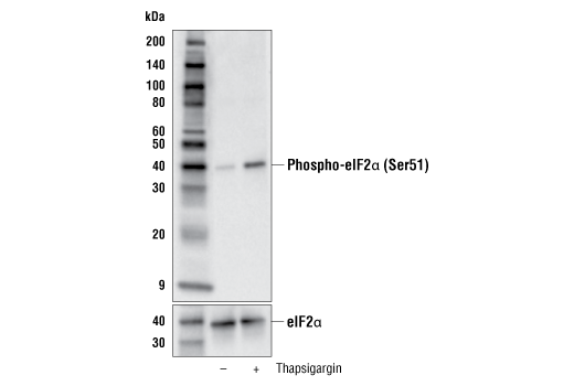 Western Blotting Image 1: Phospho-eIF2α (Ser51) (E8U8L) Mouse mAb