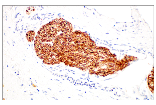 Immunohistochemistry Image 5: Neurofilament-M (E7Y8W) Mouse mAb
