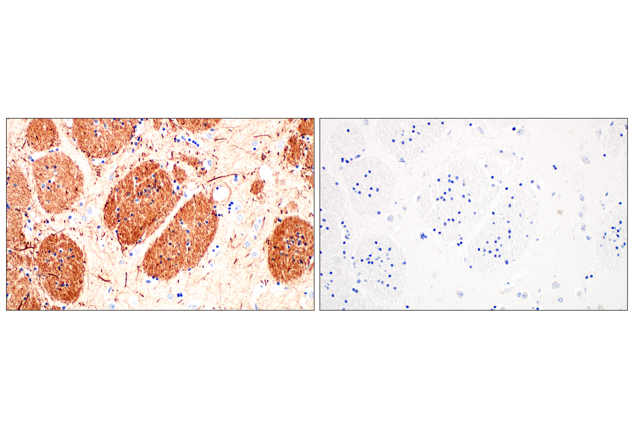 Immunohistochemistry Image 7: Neurofilament-M (E7Y8W) Mouse mAb