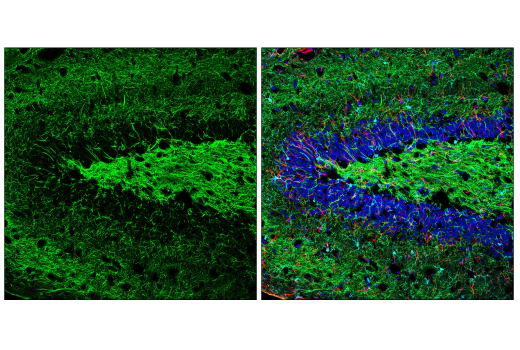 Immunofluorescence Image 1: Neurofilament-M (E7Y8W) Mouse mAb