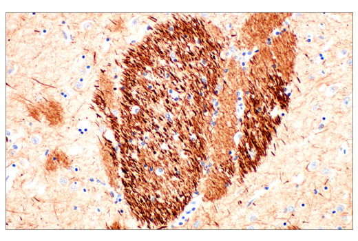 Immunohistochemistry Image 4: Neurofilament-M (E7Y8W) Mouse mAb