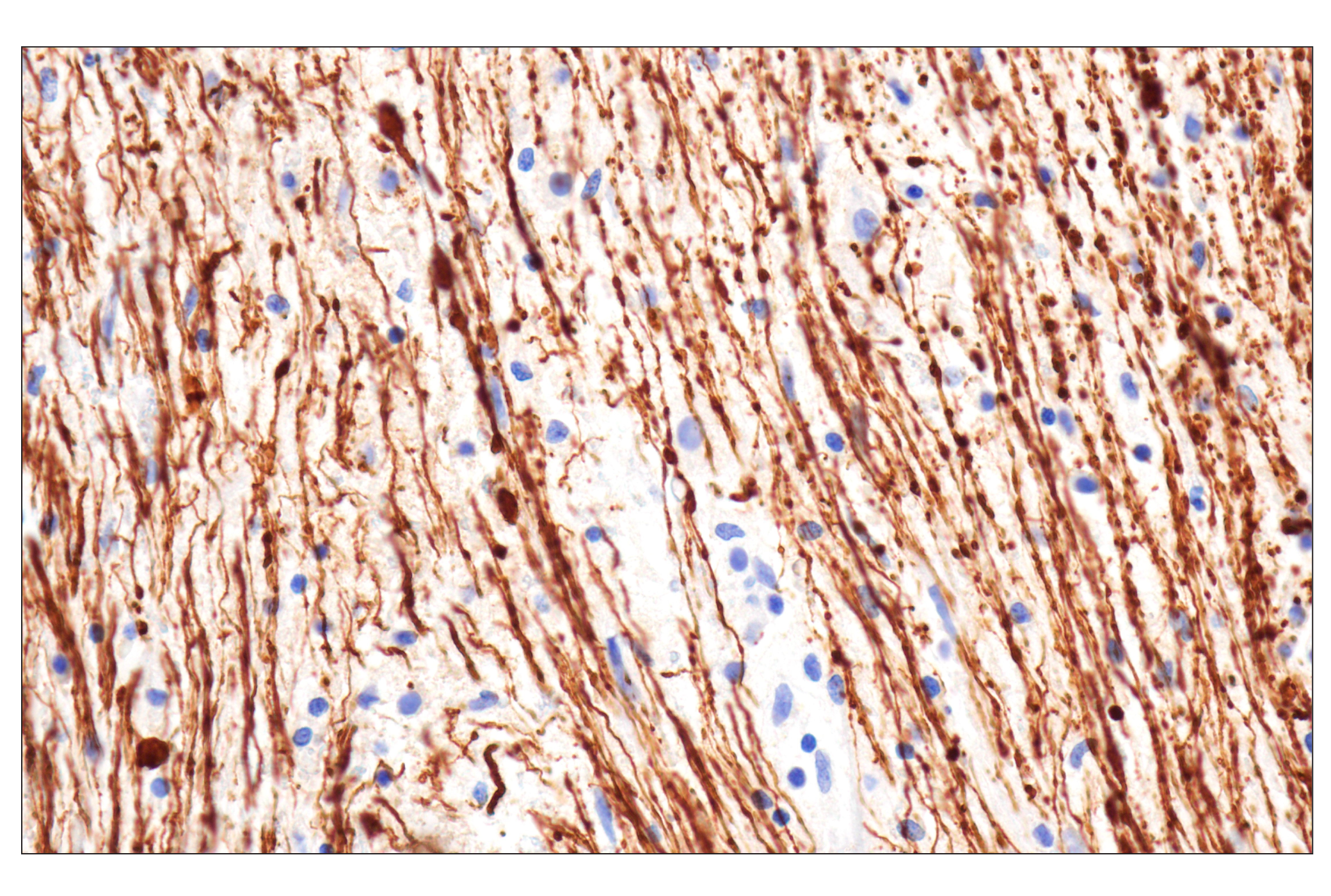 Immunohistochemistry Image 1: Neurofilament-M (E7Y8W) Mouse mAb