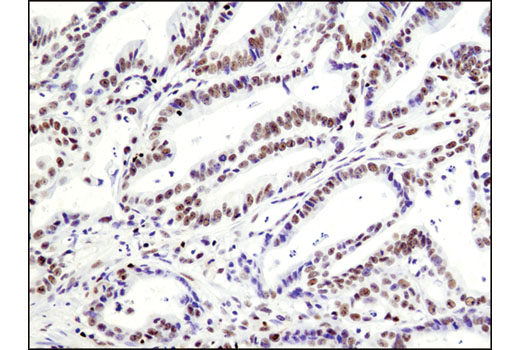  Image 17: Notch Activated Targets Antibody Sampler Kit