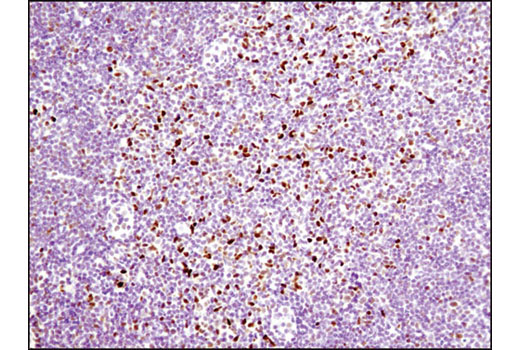 Immunohistochemistry Image 5: RBPSUH (D10A4) XP® Rabbit mAb