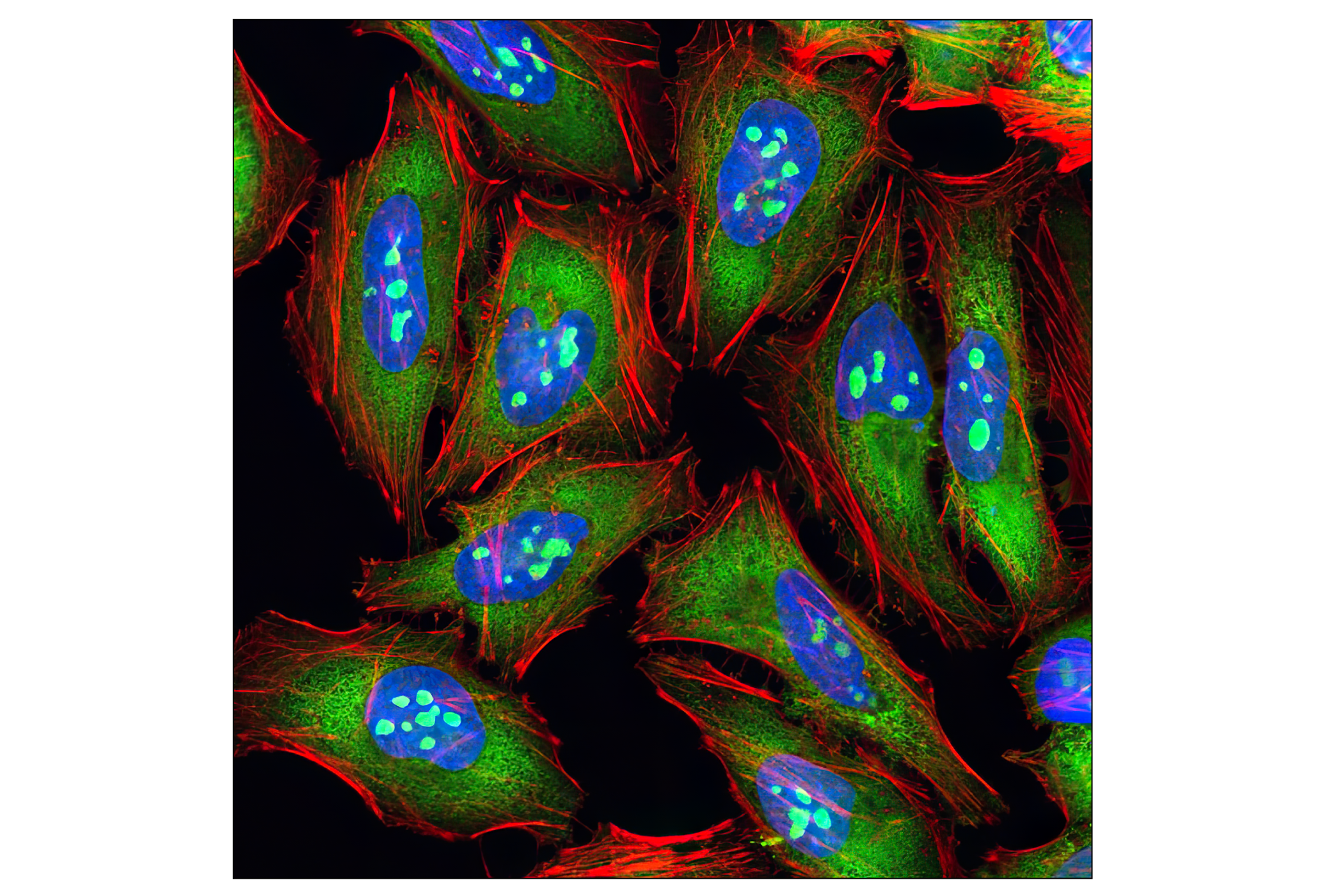Immunofluorescence Image 2: S6 Ribosomal Protein (54D2) Mouse mAb (Alexa Fluor® 488 Conjugate)
