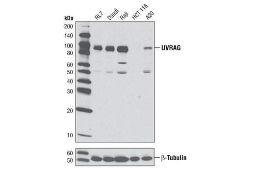 Western Blotting Image 1: UVRAG Antibody