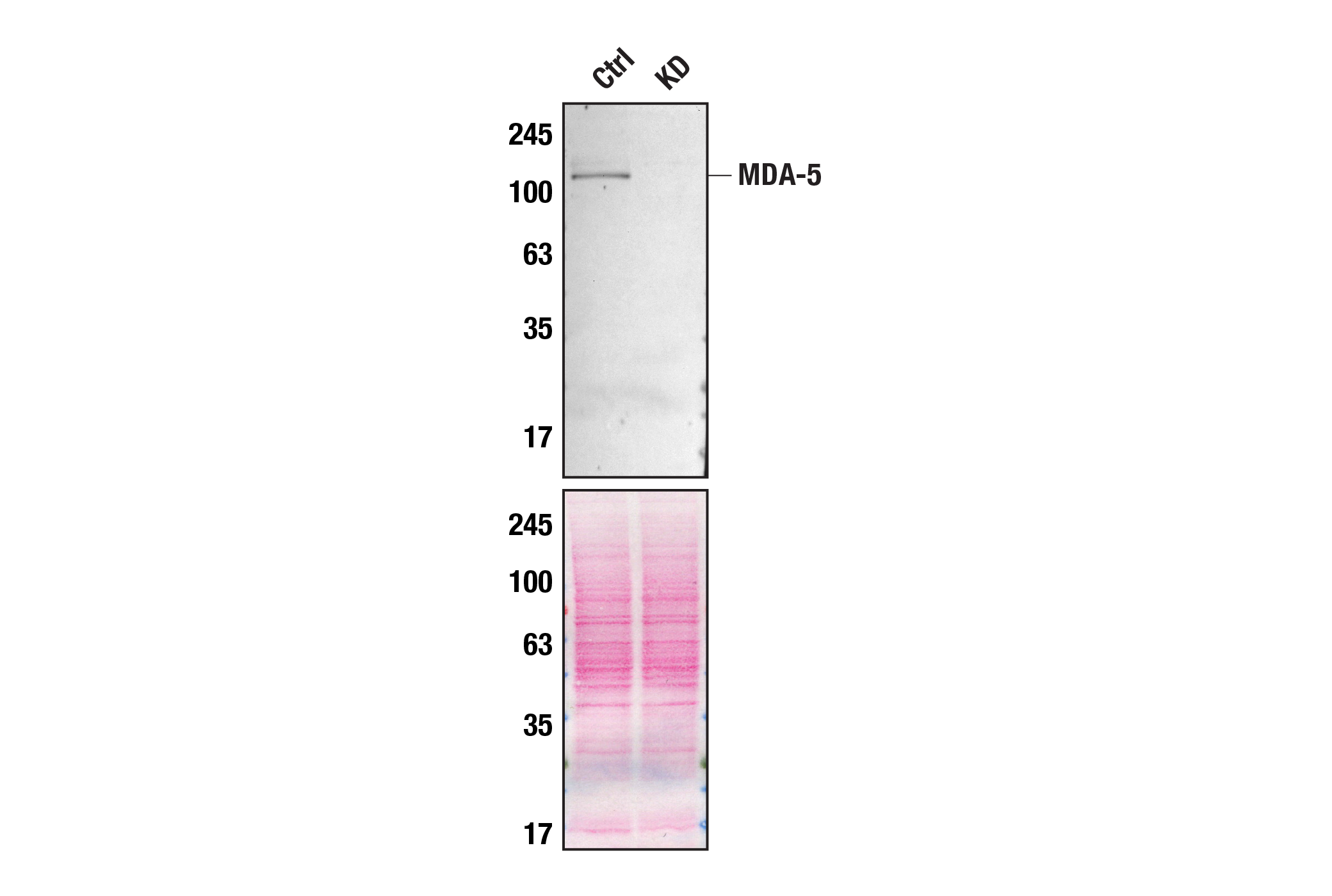 Western Blotting Image 3: MDA-5 (D74E4) Rabbit Monoclonal Antibody