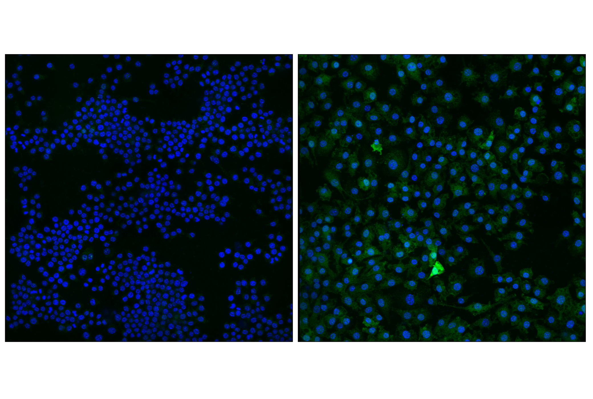 Immunofluorescence Image 1: USP18 (E9K4X) Rabbit mAb