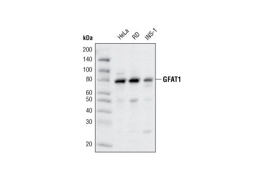  Image 4: Glutamine Metabolism Antibody Sampler Kit