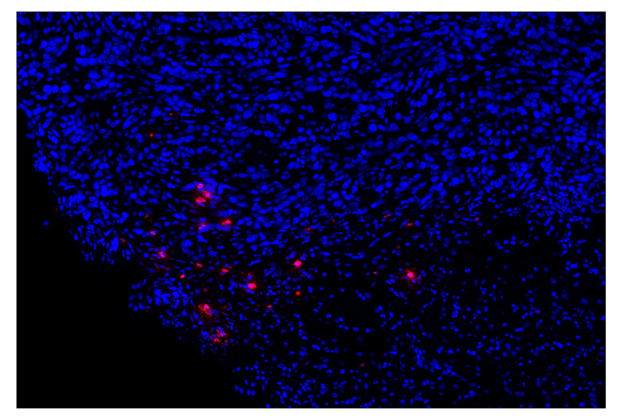 Immunohistochemistry Image 2: Eosinophil cationic protein (F3G7N) & CO-0230-488 SignalStar<sup>®</sup> Oligo-Antibody Pair