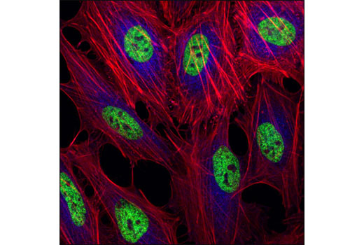 Immunofluorescence Image 1: Mono-Methyl-Histone H3 (Lys4) (D1A9) XP® Rabbit mAb