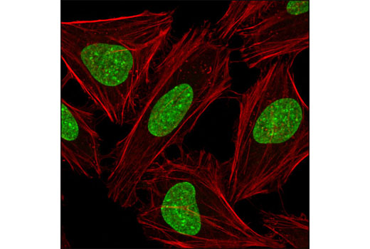 Immunofluorescence Image 1: Di/Tri-Methyl-Histone H3 (Lys9) (6F12) Mouse mAb