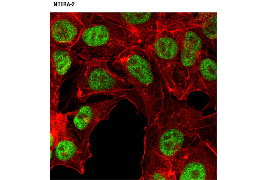 Immunofluorescence Image 1: JMJD2A (C37E5) Rabbit mAb