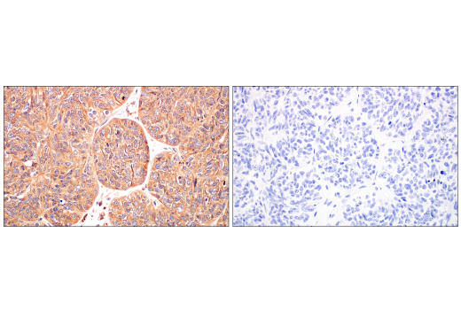 Immunohistochemistry Image 1: ILK1 (4G9) Rabbit mAb (BSA and Azide Free)