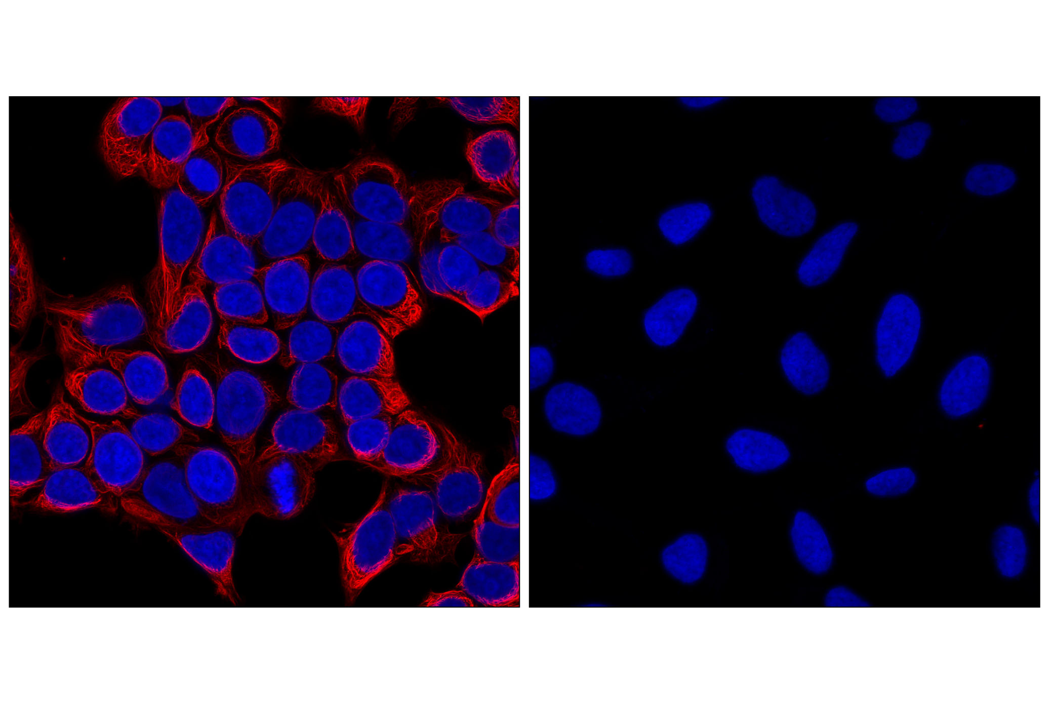 Immunofluorescence Image 1: Keratin 8/18 (C51) Mouse mAb (Alexa Fluor® 647 Conjugate)