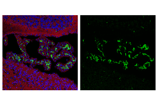 Immunofluorescence Image 2: Desmin (D93F5) XP® Rabbit mAb
