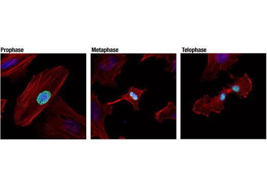 Immunofluorescence Image 1: Phospho-Histone H3 (Ser10) (D7N8E) XP® Rabbit mAb