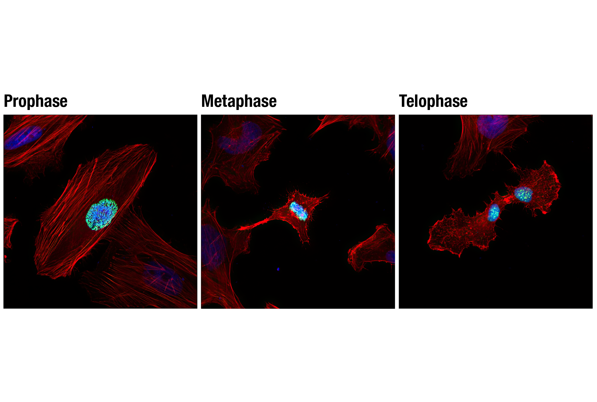 Immunofluorescence Image 1: Phospho-Histone H3 (Ser10) (D7N8E) XP® Rabbit mAb