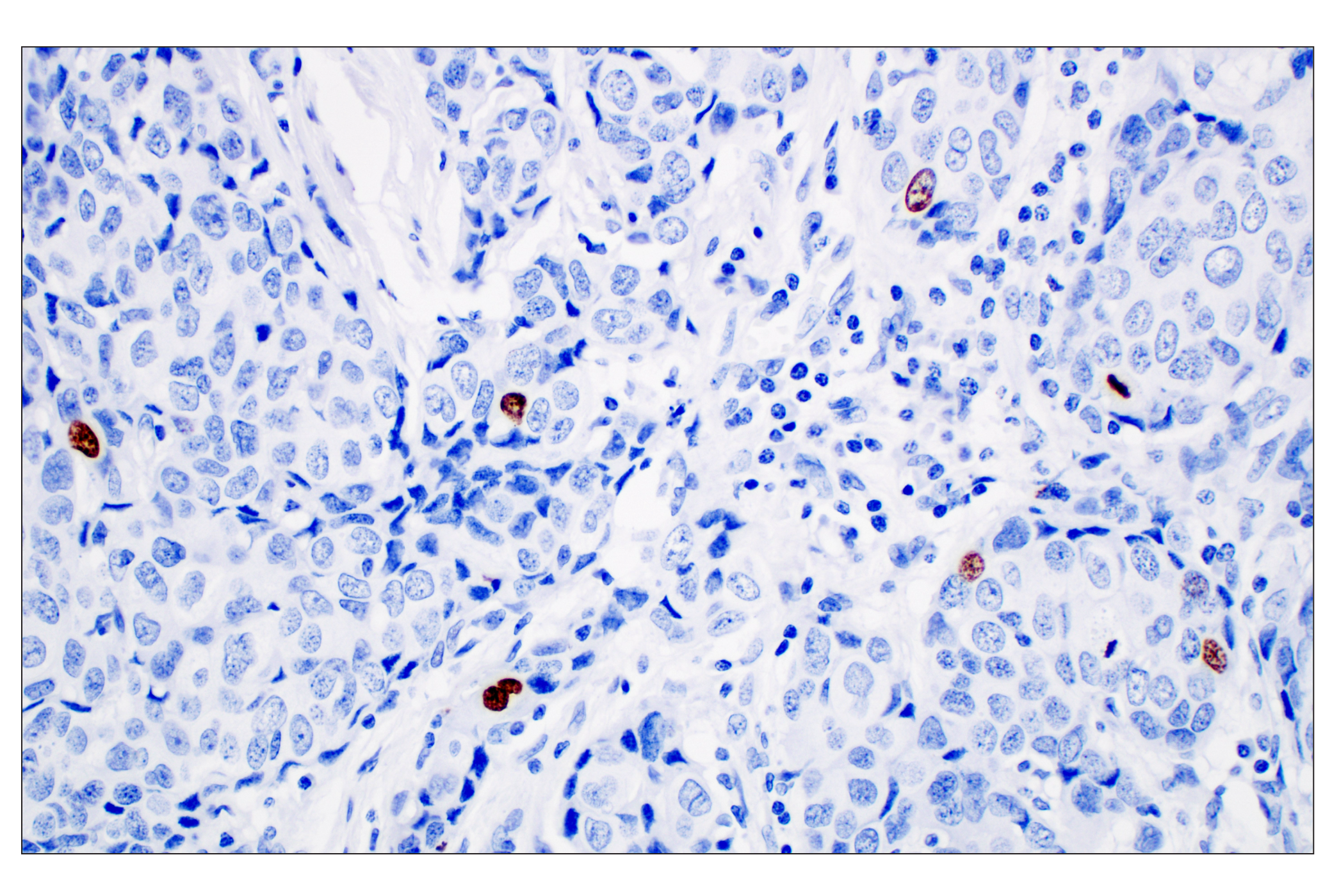 Immunohistochemistry Image 4: Phospho-Histone H3 (Ser10) (D7N8E) Rabbit Monoclonal Antibody