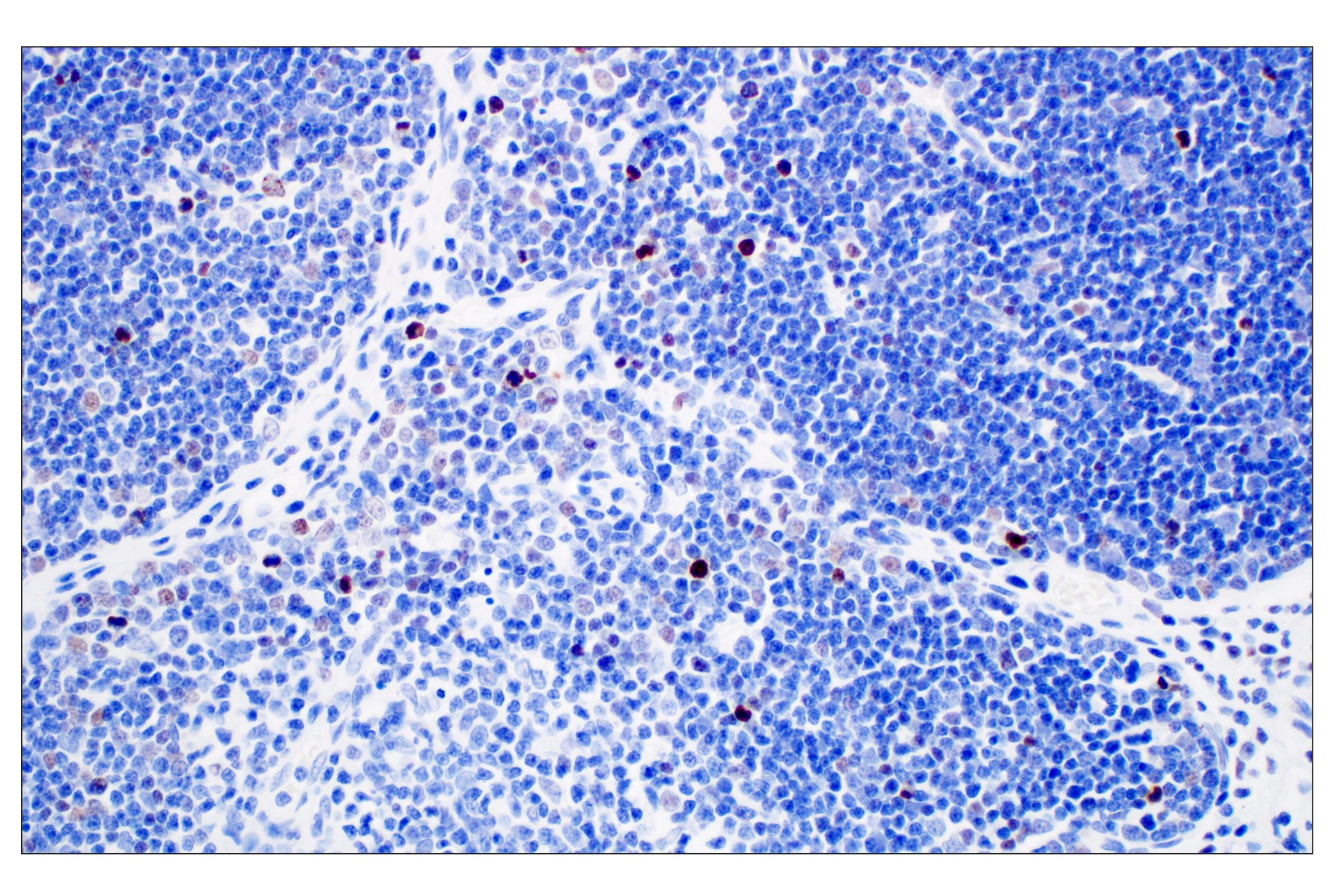 Immunohistochemistry Image 5: Phospho-Histone H3 (Ser10) (D7N8E) Rabbit Monoclonal Antibody