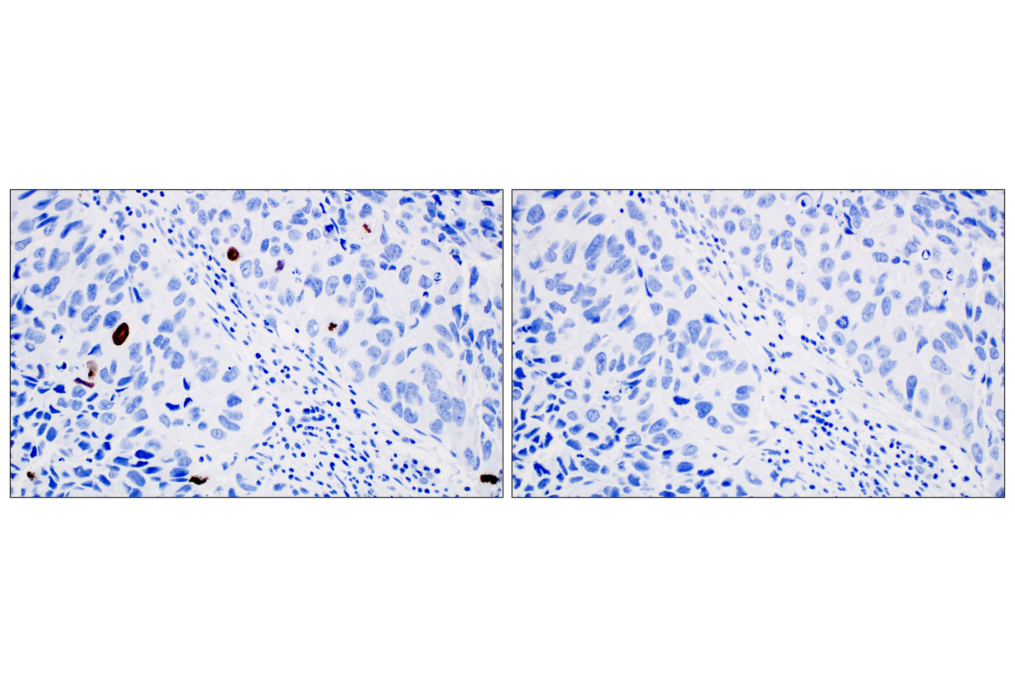 Immunohistochemistry Image 13: Phospho-Histone H3 (Ser10) (D7N8E) Rabbit Monoclonal Antibody
