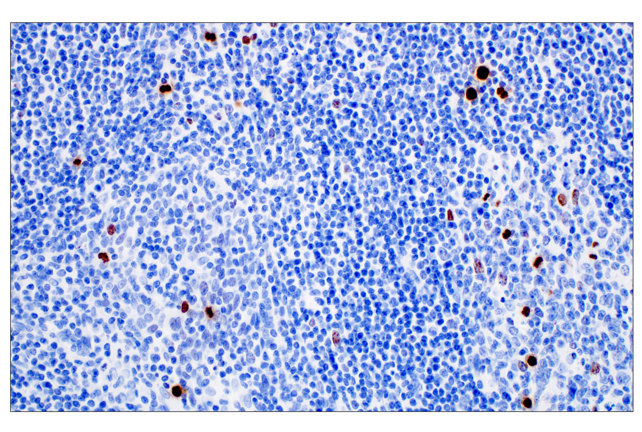 Immunohistochemistry Image 7: Phospho-Histone H3 (Ser10) (D7N8E) Rabbit Monoclonal Antibody