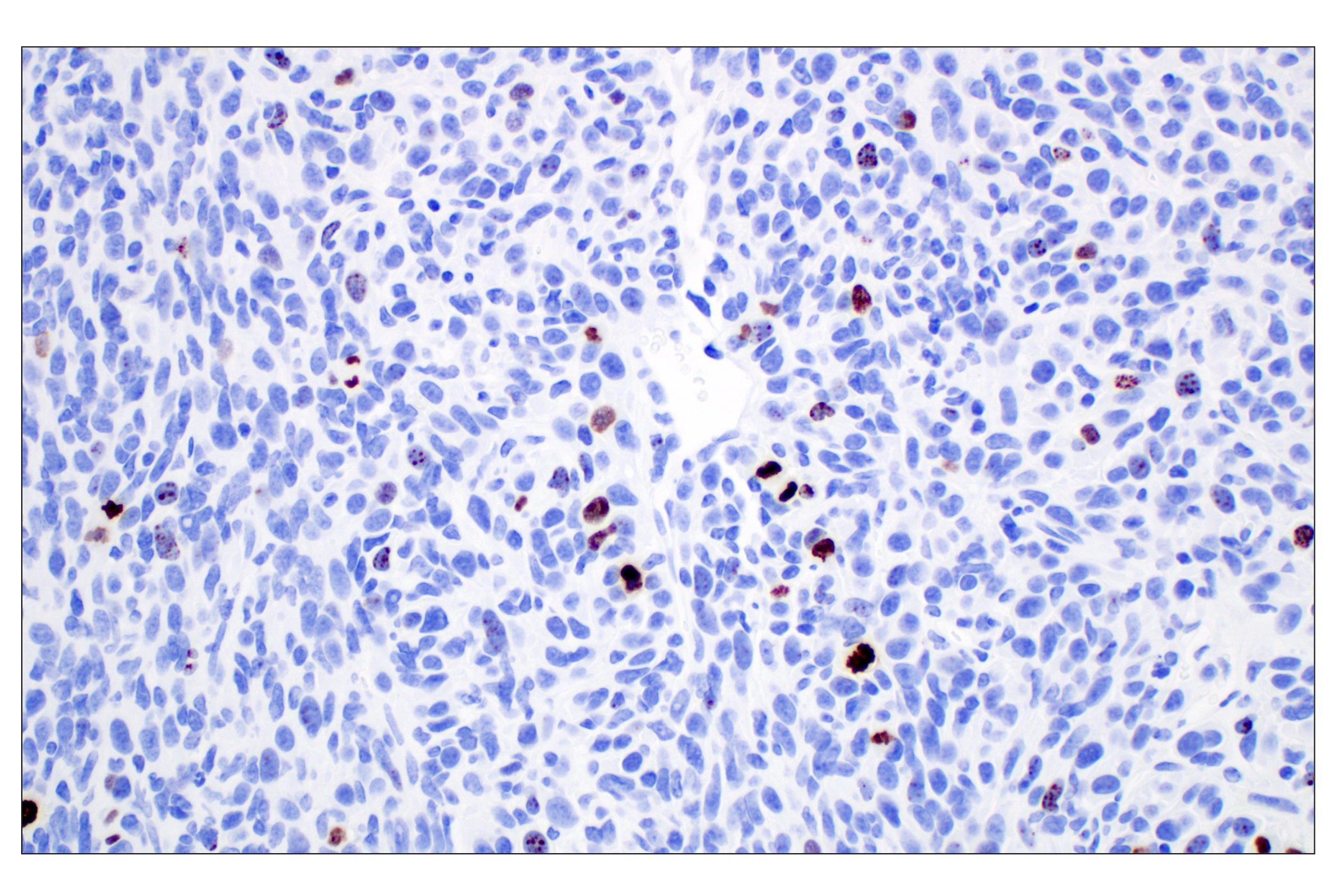 Immunohistochemistry Image 9: Phospho-Histone H3 (Ser10) (D7N8E) Rabbit Monoclonal Antibody