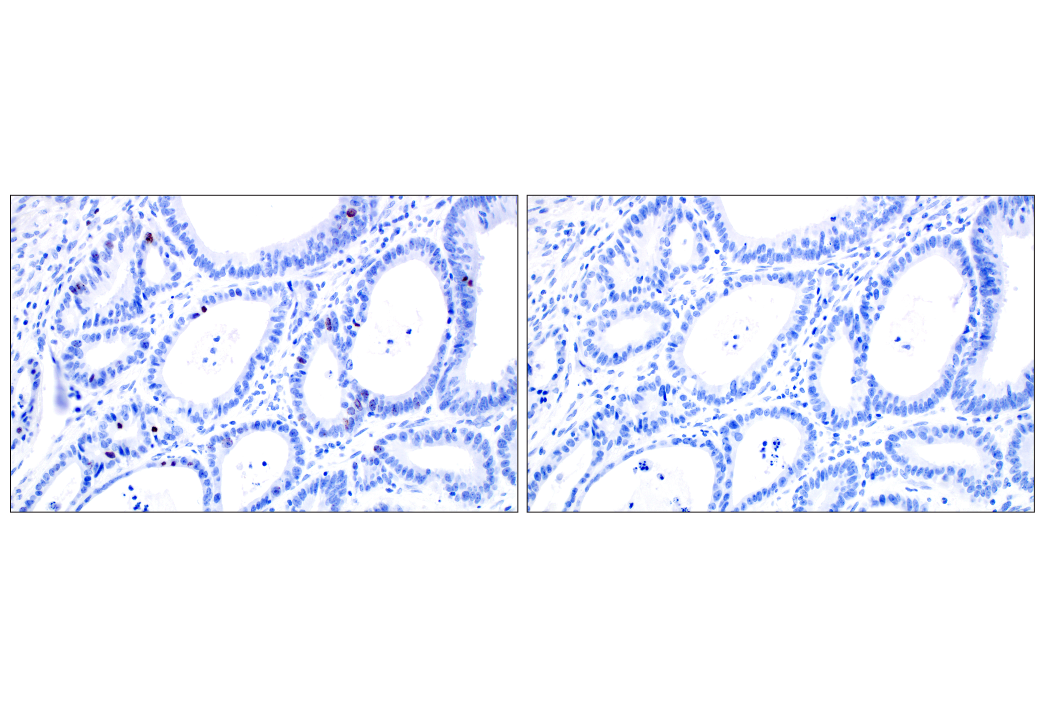 Immunohistochemistry Image 8: Phospho-Histone H3 (Ser10) (D7N8E) Rabbit Monoclonal Antibody