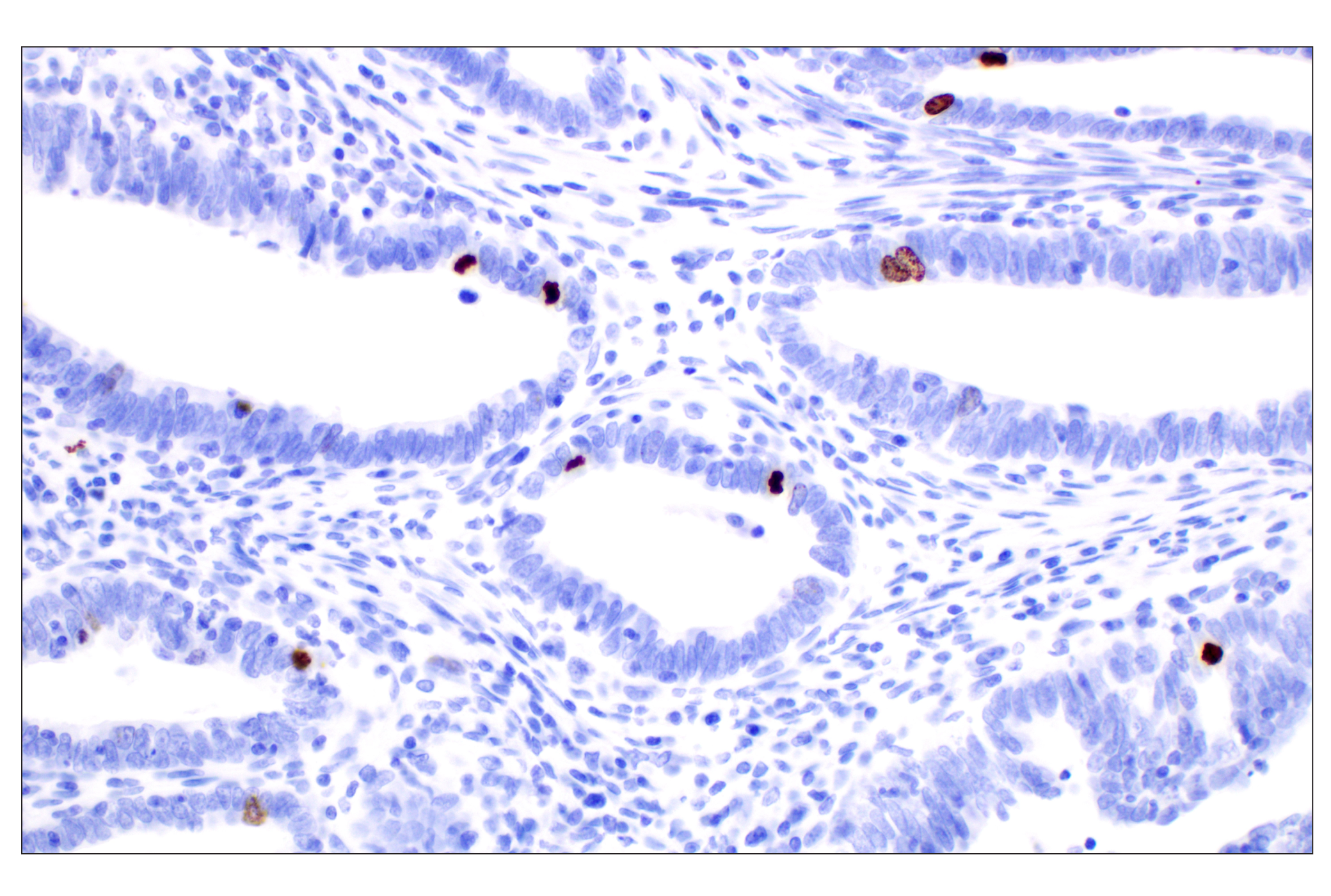 Immunohistochemistry Image 2: Phospho-Histone H3 (Ser10) (D7N8E) Rabbit Monoclonal Antibody